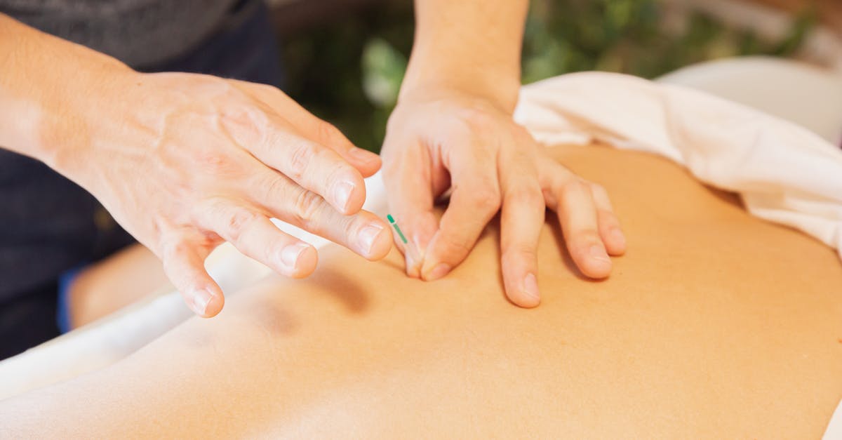 How to apply for a Hong Kong visa from Macao? - From above of crop anonymous man applying needles on back of client during acupuncture procedure