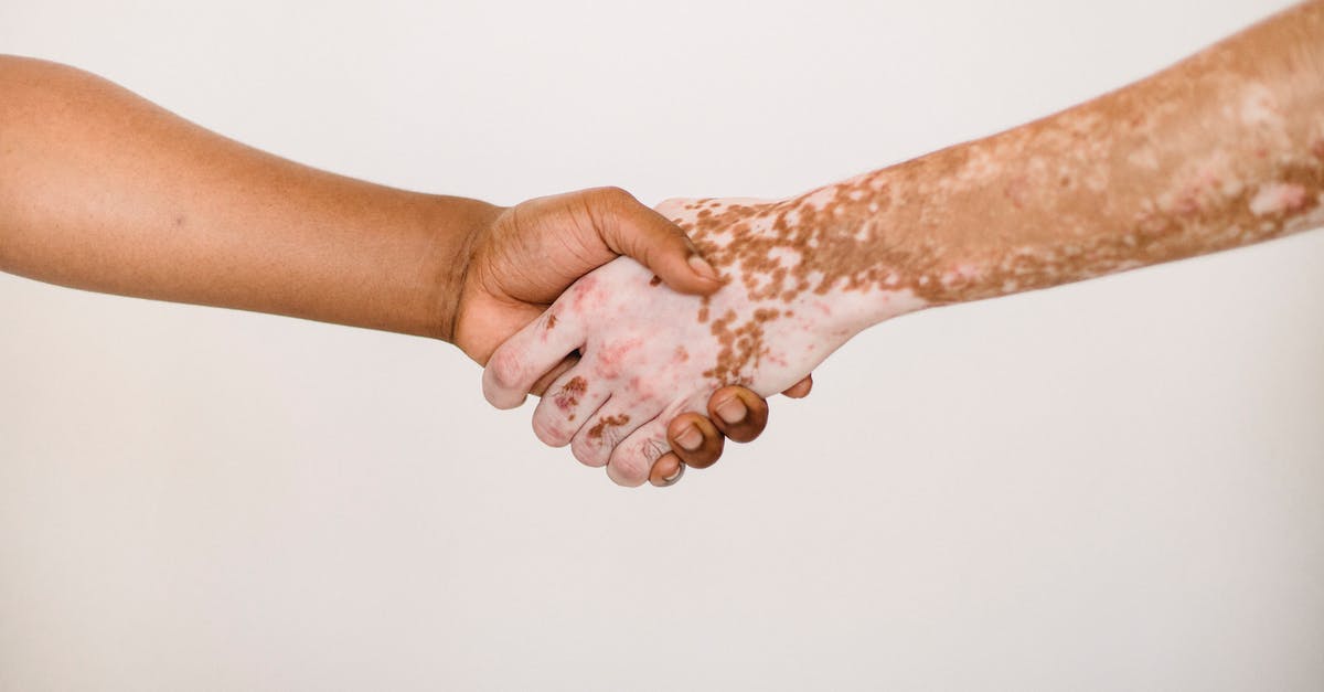 Moldova e-visa application help - Crop anonymous man shaking hand of male friend with vitiligo skin against white background