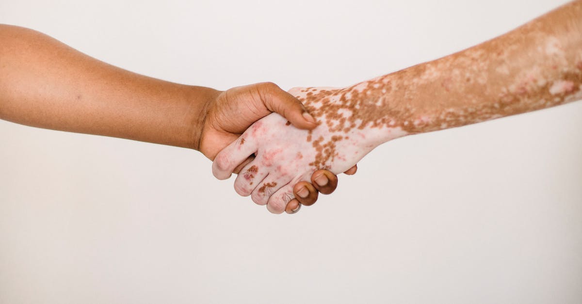 My ESTA approval if I have previously had a B1 refusal - Crop anonymous man shaking hand of male friend with vitiligo skin against white background