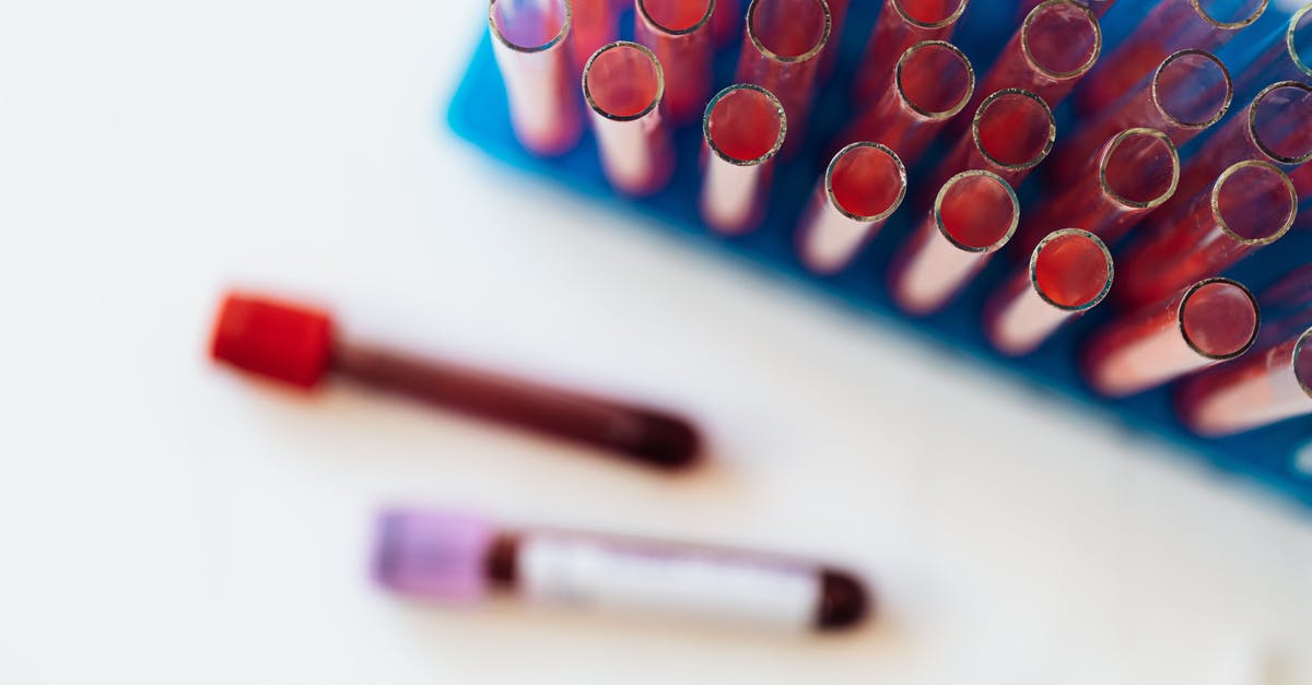 Supplying your own needle for Blood test for a Kurdistan residency permit - Top view of glass covered tubes arranged on table near plastic stand with tubes placed on row in modern laboratory