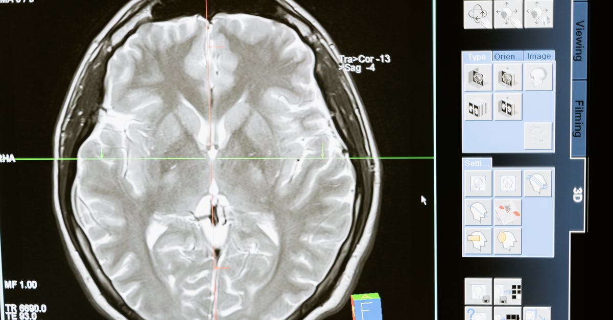 To how much radiation are you exposed on a transcontinental flight? - Free stock photo of analysis, anatomy, brain