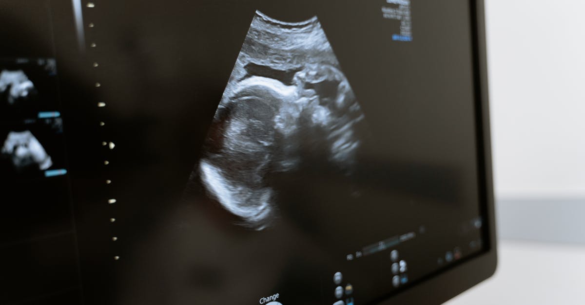 US Healthcare consultation for visitors - Free stock photo of 3d scanning, 3d ultrasound, analysis