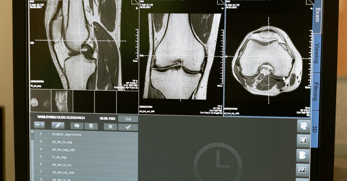 virgin australia 1 PC baggage interpretation - Free stock photo of analysis, anatomy, bone