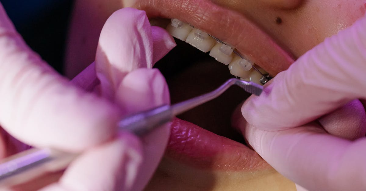 Why are there additional fees for checking in? [closed] - Treating of a Teeth with Braces